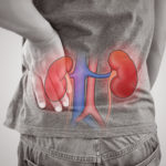 Acute Glomerulonephritis - Commonwealth Nephrology Associates