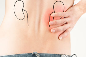 kidney disease