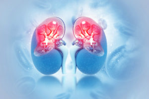Chronic Kidney Disease