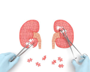 Kidney Doctor