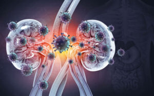 Kidney disease concept. Viral infection. 3d illustration