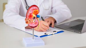 Mockup kidney on work desk of Nephrologist