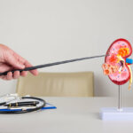 Doctor nephrologist pointing at pyelonephritis showing pus,infection