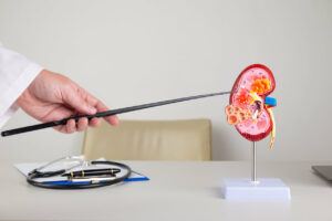 Doctor nephrologist pointing at pyelonephritis showing pus,infection