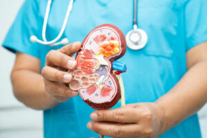 Nephrologist hold Kidney model to study and treat in hospital