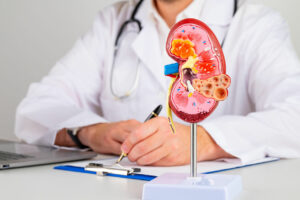 A mockup of a kidney anatomy model is displayed on the desk of a kidney doctor.
