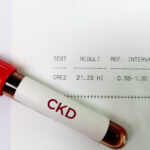 Blood sample isolated with Chronic Kidney disease or CKD, high Creatinine and BUN report.